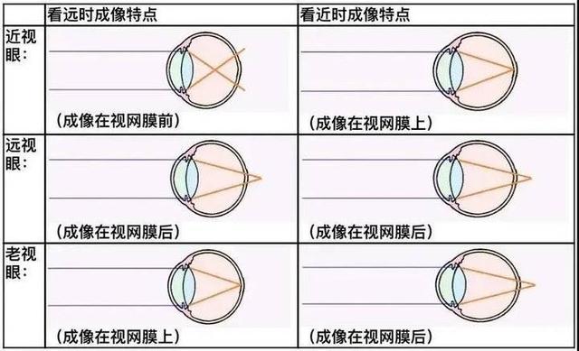 老花与近视和远视有什么区别？