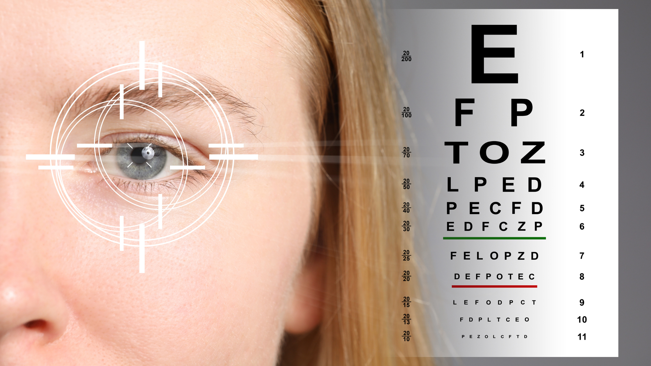 Cost Differences Every Patient Should Know About ICL & LASIK