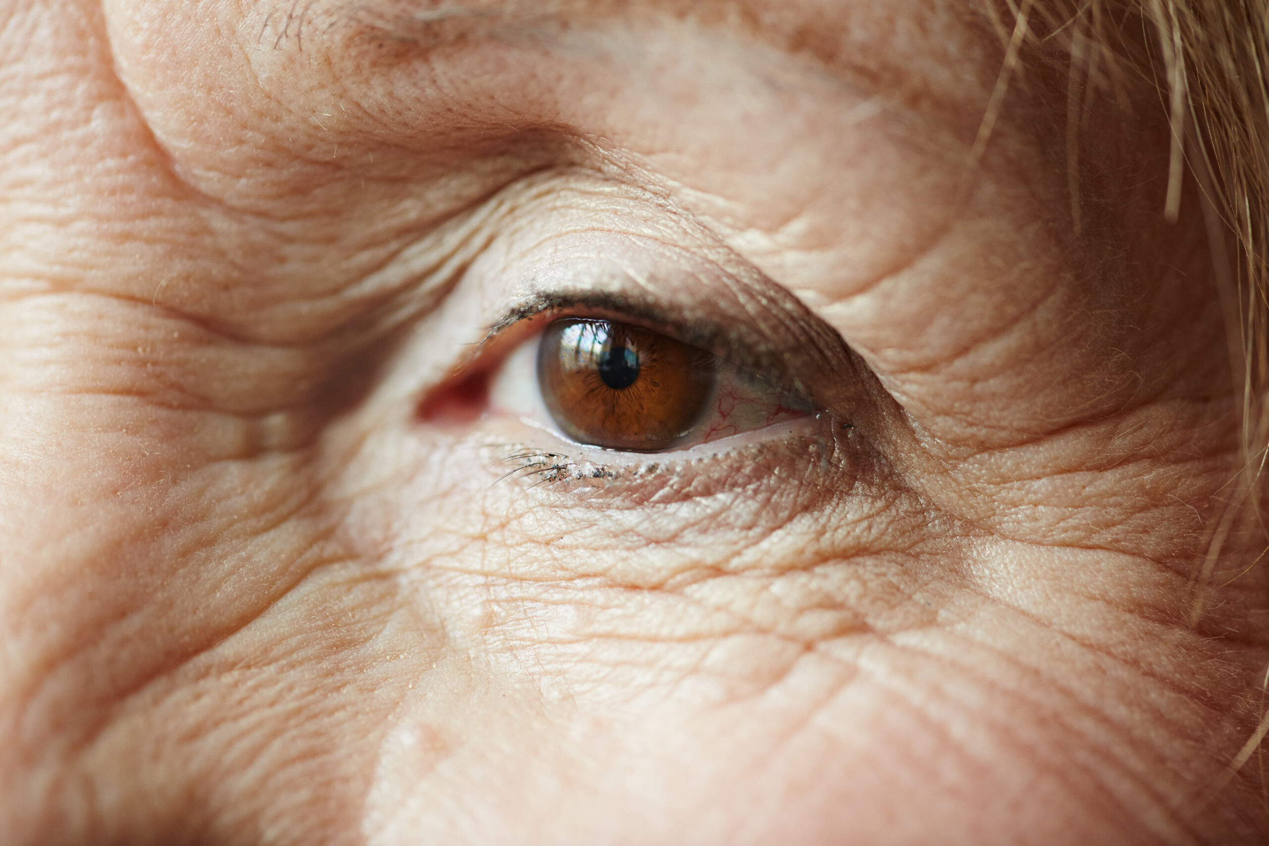 Female eye of elderly woman with cataract