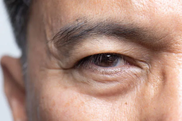 What Can You Expect After Surgery?
